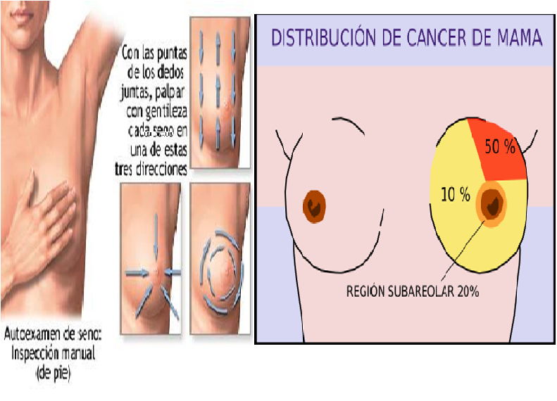 Donde duele el cancer de pulmon